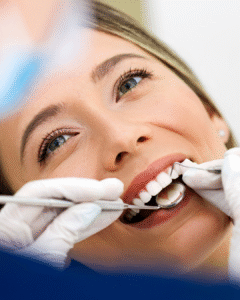 Limpeza Dentária (Prevenção Bucal)
